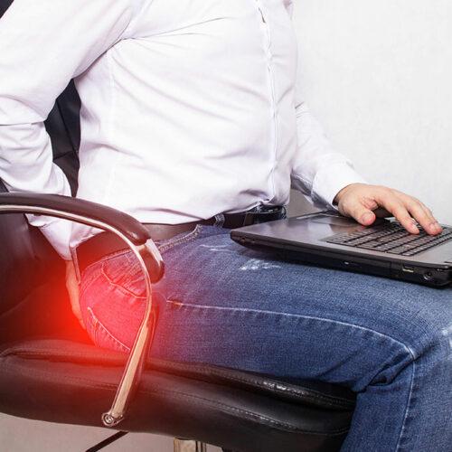 4 Types of Hemorrhoids and Treatments