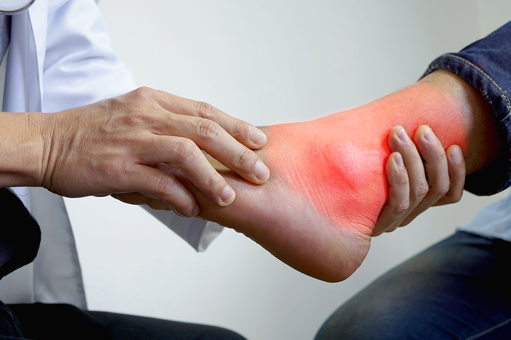 8 Old-Timey Remedies for Gout