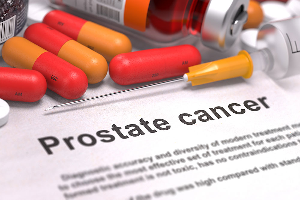 Possible Treatment Options for Prostate Cancer
