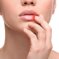 How to Treat Cold Sores at Home?