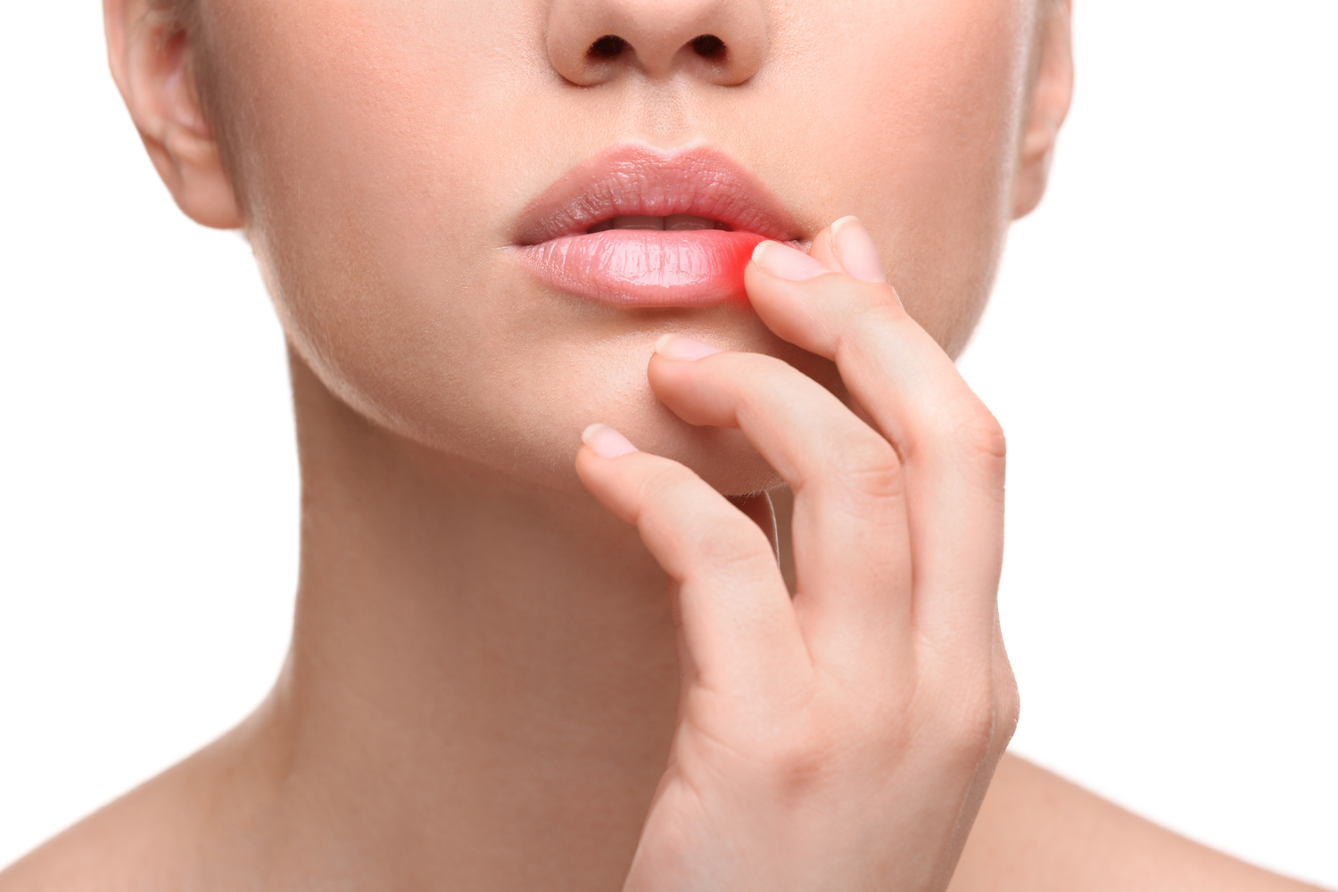 How to Treat Cold Sores at Home?
